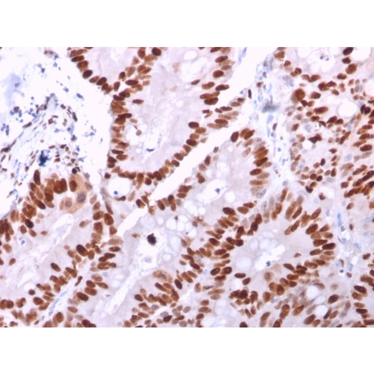 Immunohistochemistry - Anti-MCM6 Antibody [MCM6/2999] - BSA and Azide free (A252478) - Antibodies.com