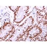 Immunohistochemistry - Anti-MCM6 Antibody [MCM6/2999] - BSA and Azide free (A252478) - Antibodies.com