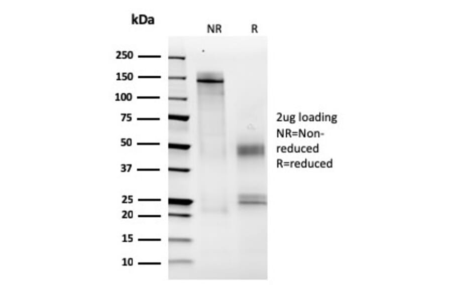 SDS-PAGE - Anti-MCM6 Antibody [MCM6/2999] - BSA and Azide free (A252478) - Antibodies.com