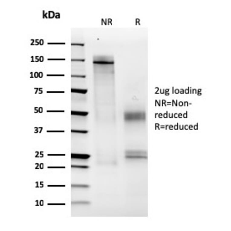 SDS-PAGE - Anti-MCM6 Antibody [MCM6/2999] - BSA and Azide free (A252478) - Antibodies.com