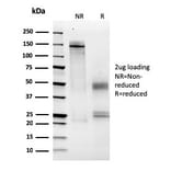 SDS-PAGE - Anti-MCM6 Antibody [MCM6/2999] - BSA and Azide free (A252478) - Antibodies.com