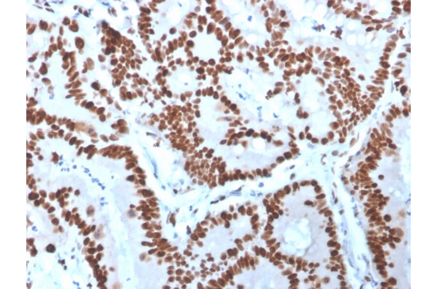 Immunohistochemistry - Anti-MCM6 Antibody [MCM6/3000] - BSA and Azide free (A252479) - Antibodies.com