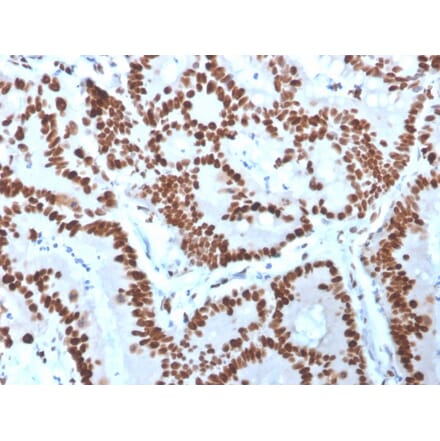 Immunohistochemistry - Anti-MCM6 Antibody [MCM6/3000] - BSA and Azide free (A252479) - Antibodies.com
