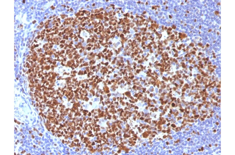 Immunohistochemistry - Anti-MCM7 Antibody [MCM7/1466] - BSA and Azide free (A252479) - Antibodies.com