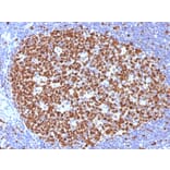 Immunohistochemistry - Anti-MCM7 Antibody [MCM7/1466] - BSA and Azide free (A252479) - Antibodies.com