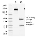 SDS-PAGE - Anti-MCM7 Antibody [MCM7/1466] - BSA and Azide free (A252480) - Antibodies.com