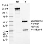 SDS-PAGE - Anti-MCM7 Antibody [MCM7/1468] - BSA and Azide free (A252482) - Antibodies.com