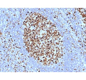 Immunohistochemistry - Anti-MCM7 Antibody [SPM379] - BSA and Azide free (A252483) - Antibodies.com