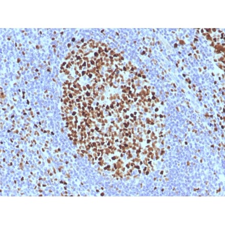 Immunohistochemistry - Anti-MCM7 Antibody [SPM379] - BSA and Azide free (A252483) - Antibodies.com