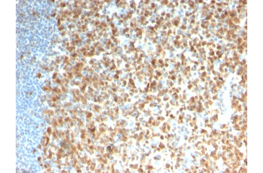 Immunohistochemistry - Anti-MCM7 Antibody [rMCM7/1468] - BSA and Azide free (A252485) - Antibodies.com
