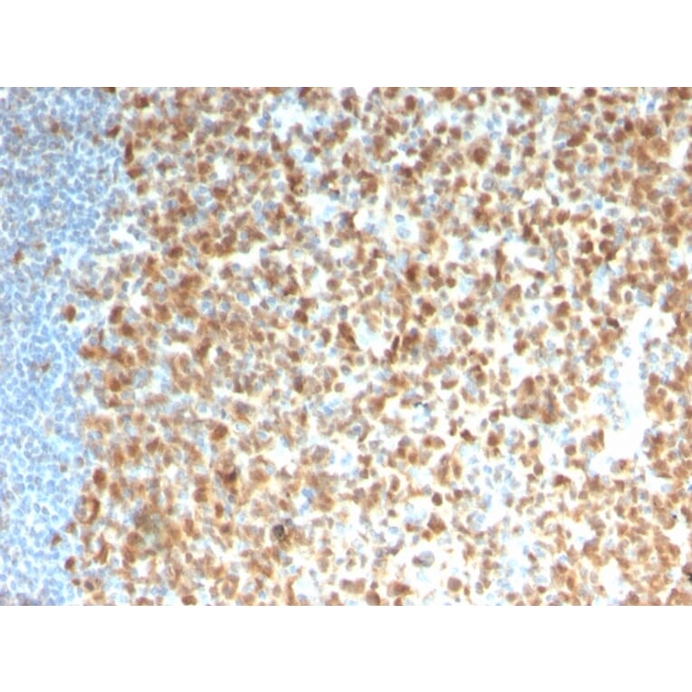 Immunohistochemistry - Anti-MCM7 Antibody [rMCM7/1468] - BSA and Azide free (A252485) - Antibodies.com