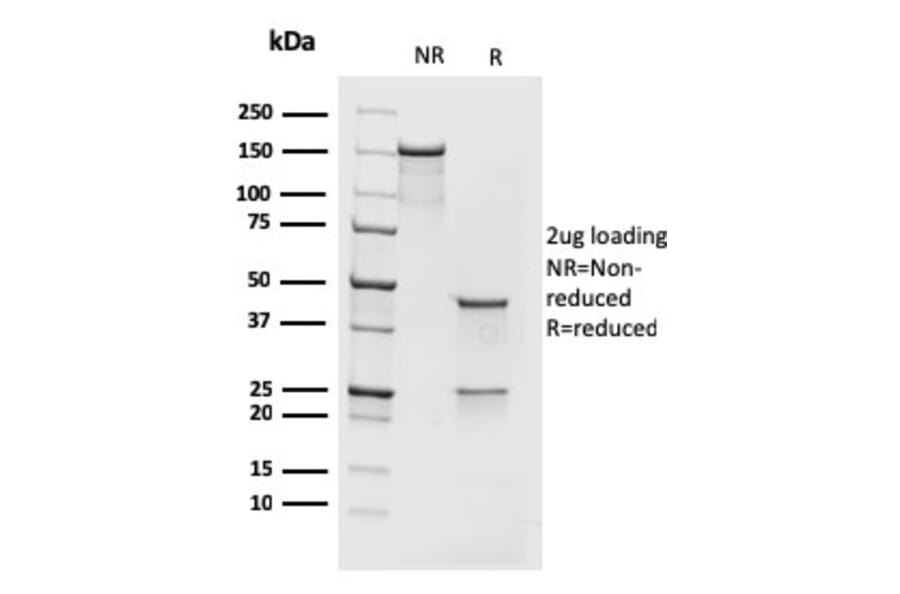 SDS-PAGE - Anti-MCM7 Antibody [rMCM7/1468] - BSA and Azide free (A252485) - Antibodies.com