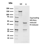 SDS-PAGE - Anti-MCM7 Antibody [rMCM7/1468] - BSA and Azide free (A252485) - Antibodies.com