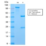 SDS-PAGE - Anti-MCM7 Antibody [MCM7/2756R] - BSA and Azide free (A252486) - Antibodies.com