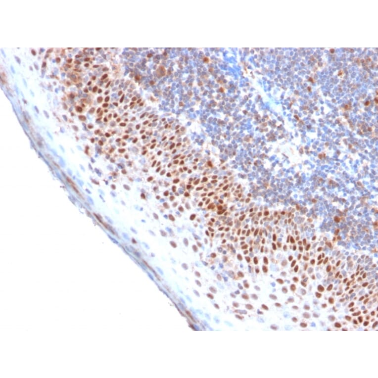 Immunohistochemistry - Anti-MCM7 Antibody [MCM7/2756R] - BSA and Azide free (A252485) - Antibodies.com