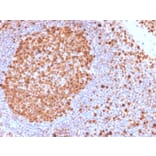 Immunohistochemistry - Anti-MCM7 Antibody [MCM7/2832R] - BSA and Azide free (A252487) - Antibodies.com