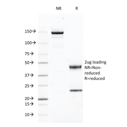 SDS-PAGE - Anti-CD46 Antibody [169-1-E4.3] - BSA and Azide free (A252488) - Antibodies.com