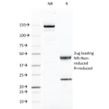 SDS-PAGE - Anti-CD46 Antibody [169-1-E4.3] - BSA and Azide free (A252488) - Antibodies.com