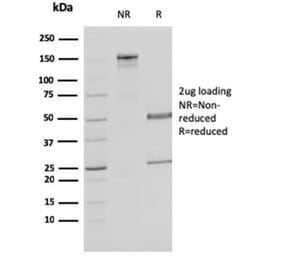 SDS-PAGE - Anti-MDH1 Antibody [CPTC-MDH1-1] - BSA and Azide free (A252489) - Antibodies.com