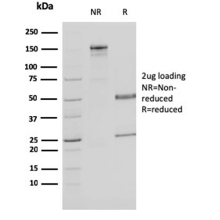 SDS-PAGE - Anti-MDH1 Antibody [CPTC-MDH1-1] - BSA and Azide free (A252489) - Antibodies.com