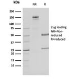 SDS-PAGE - Anti-MDH1 Antibody [CPTC-MDH1-1] - BSA and Azide free (A252489) - Antibodies.com