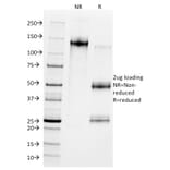 SDS-PAGE - Anti-MDM2 Antibody [SMP14] - BSA and Azide free (A252492) - Antibodies.com