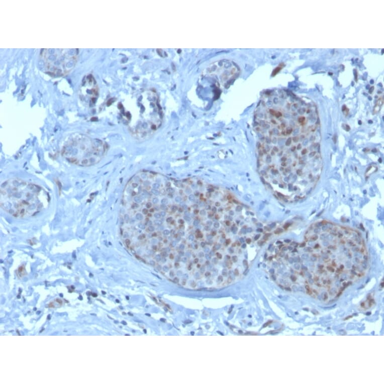 Immunohistochemistry - Anti-MDM2 Antibody [SMP14] - BSA and Azide free (A252491) - Antibodies.com