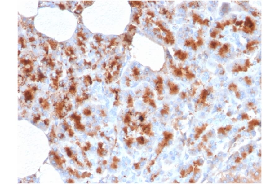 Immunohistochemistry - Anti-MDM2 Antibody [MDM2/2414] - BSA and Azide free (A252493) - Antibodies.com