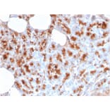 Immunohistochemistry - Anti-MDM2 Antibody [MDM2/2414] - BSA and Azide free (A252493) - Antibodies.com