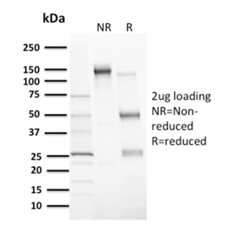 SDS-PAGE - Anti-MDM2 Antibody [MDM2/2414] - BSA and Azide free (A252493) - Antibodies.com