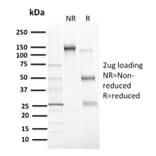 SDS-PAGE - Anti-MDM2 Antibody [MDM2/2414] - BSA and Azide free (A252493) - Antibodies.com