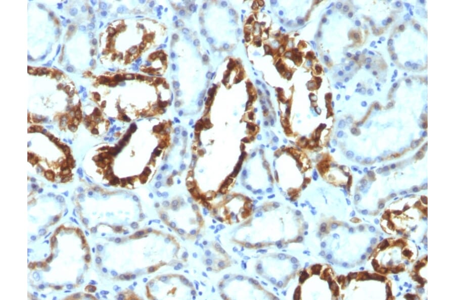 Immunohistochemistry - Anti-Milk Fat Globule Antibody [SPM291] - BSA and Azide free (A252496) - Antibodies.com