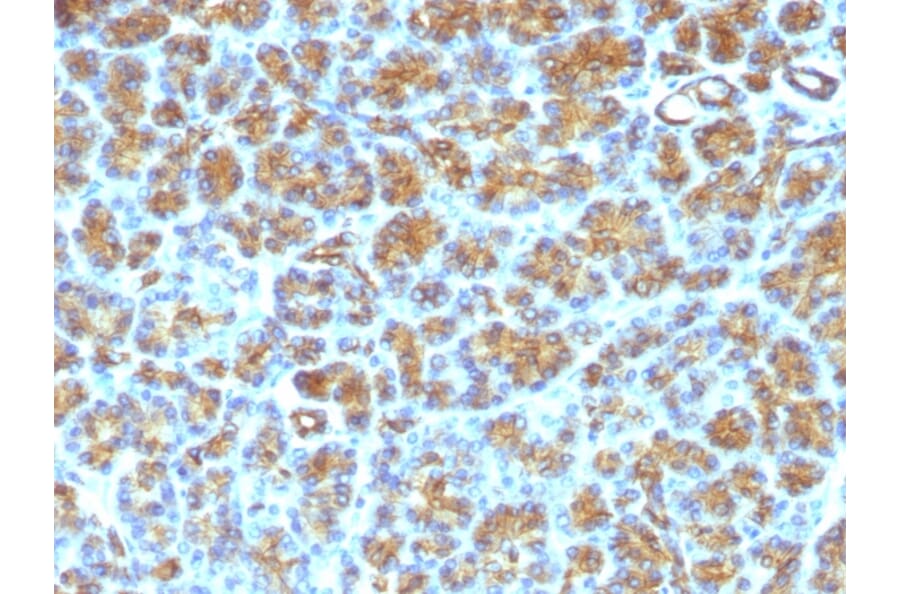 Immunohistochemistry - Anti-Milk Fat Globule Antibody [SPM291] - BSA and Azide free (A252496) - Antibodies.com