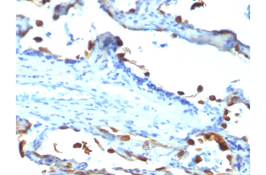 Immunohistochemistry - Anti-Milk Fat Globule Antibody [EDM45] - BSA and Azide free (A252497) - Antibodies.com