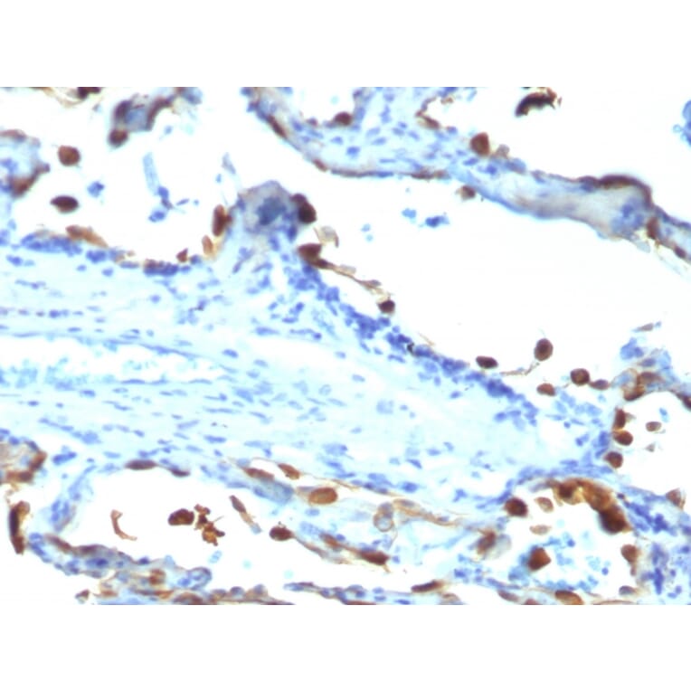Immunohistochemistry - Anti-Milk Fat Globule Antibody [EDM45] - BSA and Azide free (A252497) - Antibodies.com