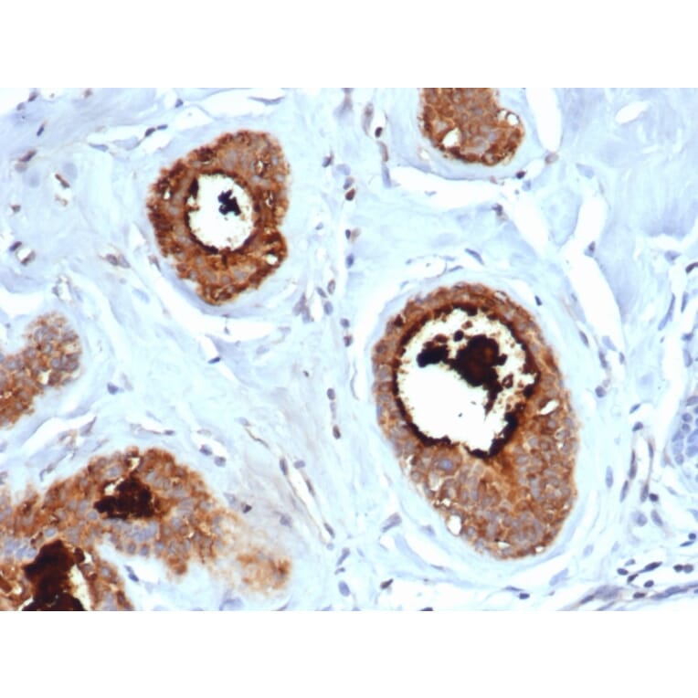 Immunohistochemistry - Anti-Mammaglobin A Antibody [rMGB/6619] - BSA and Azide free (A252497) - Antibodies.com