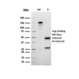 SDS-PAGE - Anti-Mammaglobin A Antibody [rMGB/6619] - BSA and Azide free (A252498) - Antibodies.com