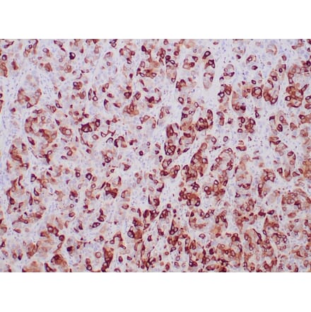 Immunohistochemistry - Anti-Mammaglobin A Antibody [MGB/2000] - BSA and Azide free (A252499) - Antibodies.com