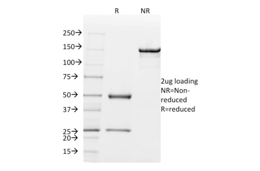 SDS-PAGE - Anti-Mammaglobin A Antibody [MGB/2000] - BSA and Azide free (A252499) - Antibodies.com