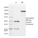 SDS-PAGE - Anti-Mammaglobin A Antibody [MGB/2000] - BSA and Azide free (A252499) - Antibodies.com