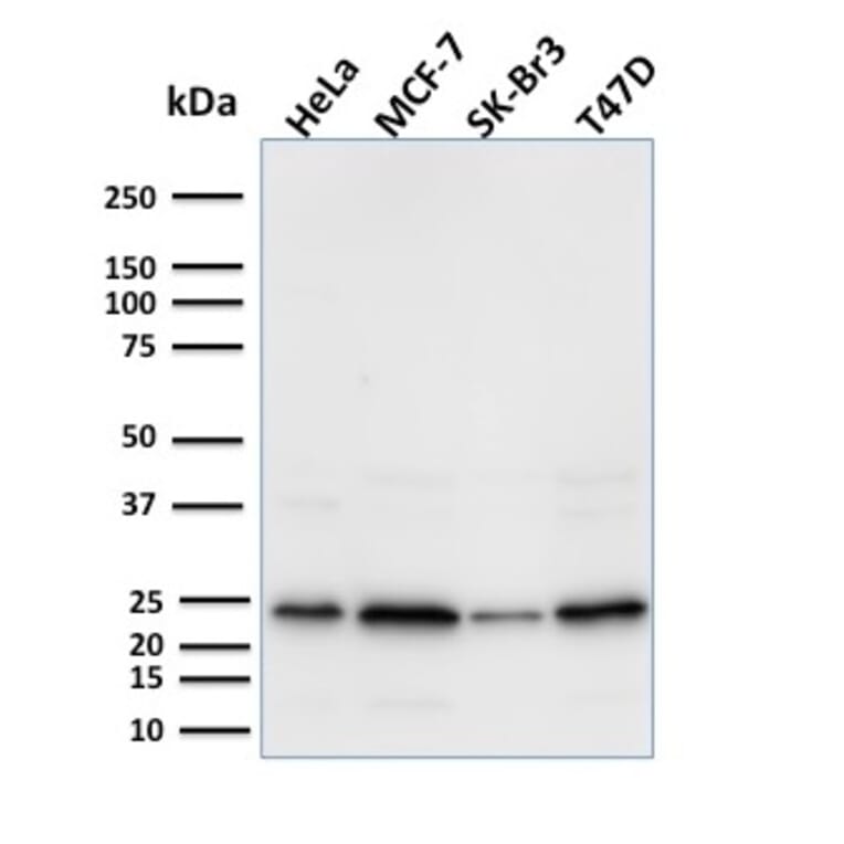 Western Blot - Anti-Mammaglobin A Antibody [MGB/2000] - BSA and Azide free (A252499) - Antibodies.com