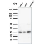 Western Blot - Anti-Mammaglobin A Antibody [SPM518] - BSA and Azide free (A252500) - Antibodies.com