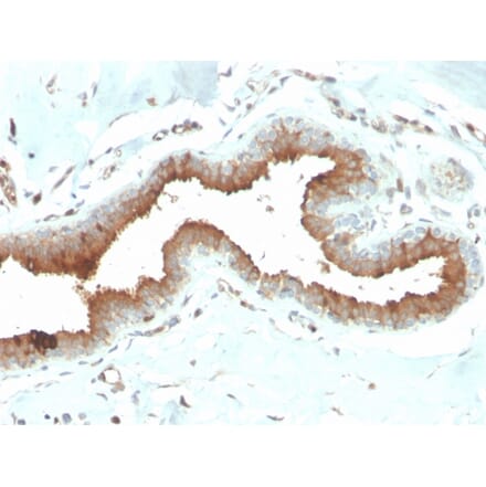Immunohistochemistry - Anti-Mammaglobin A Antibody [MGB/2704] - BSA and Azide free (A252500) - Antibodies.com