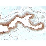 Immunohistochemistry - Anti-Mammaglobin A Antibody [MGB/2704] - BSA and Azide free (A252500) - Antibodies.com