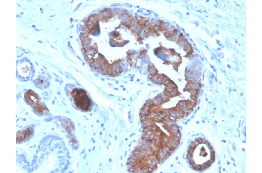 Immunohistochemistry - Anti-Mammaglobin A Antibody [MGB/4056] - BSA and Azide free (A252502) - Antibodies.com