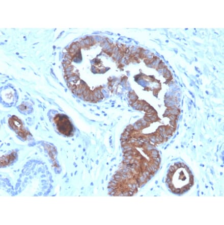 Immunohistochemistry - Anti-Mammaglobin A Antibody [MGB/4056] - BSA and Azide free (A252502) - Antibodies.com