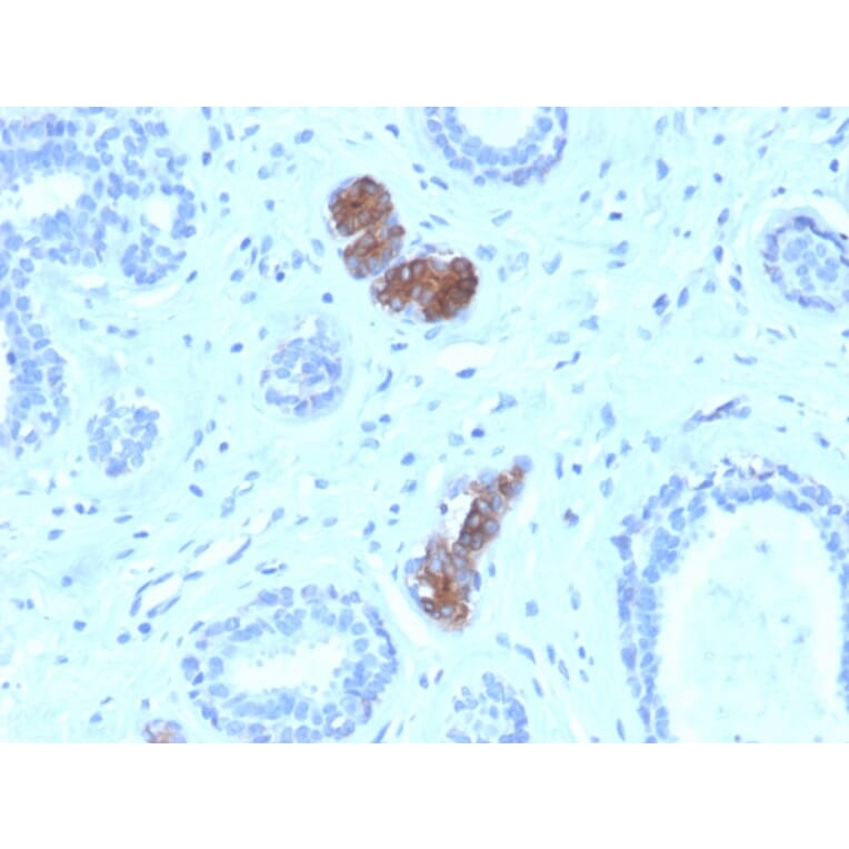 Immunohistochemistry - Anti-Mammaglobin A Antibody [MGB/4056] - BSA and Azide free (A252502) - Antibodies.com