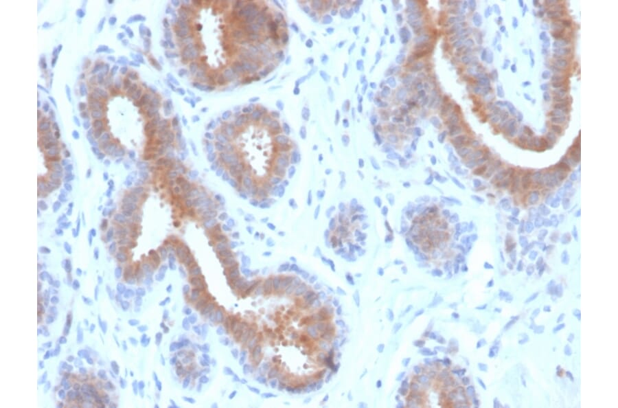 Immunohistochemistry - Anti-Mammaglobin A Antibody [rMGB/4299] - BSA and Azide free (A252502) - Antibodies.com