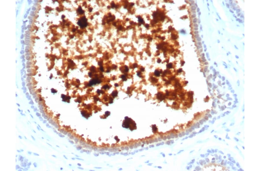 Immunohistochemistry - Anti-Mammaglobin A Antibody [MGB/4811R] - BSA and Azide free (A252503) - Antibodies.com