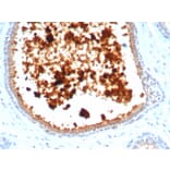 Immunohistochemistry - Anti-Mammaglobin A Antibody [MGB/4811R] - BSA and Azide free (A252503) - Antibodies.com